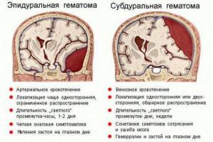 Посттравматические головные боли Посттравматическая боль