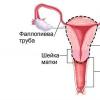 Как избежать тяжелых последствий после операции по удалению матки у женщин Угасают ли яичники после удаления матки